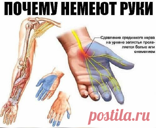 Почему немеют руки: 7 причин, заставляющих задуматься о здоровье. 
Каждому человеку не раз приходилось сталкиваться с ощущением потери чувствительности ноги или руки, сопровождающимся легким покалыванием или жжением. Зачастую это происходит из-за временного нарушения кровообращения в конечности вследствие сдавливания сосудов и нервных окончаний. Стоит начать двигаться или сменить положение, и чувствительность восстанавливается. 
И всё-таки неудобное положение во время сна, к сожалению, не единс