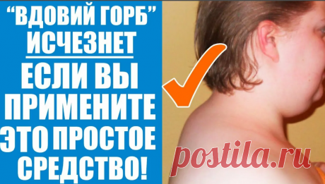Как избавиться от холки на шее?