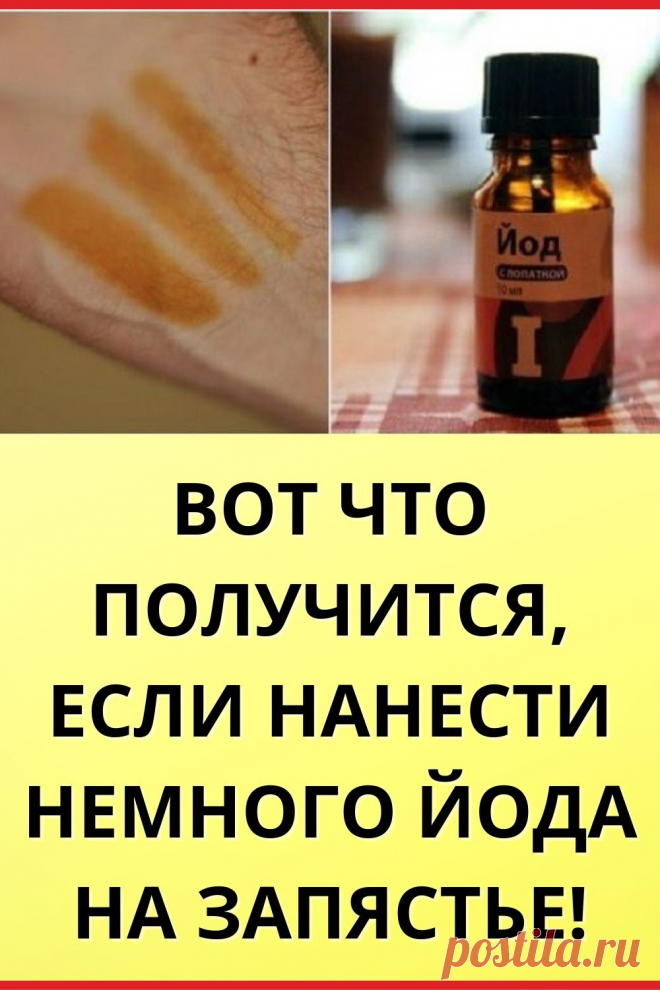 Вот что получится, если нанести немного йода на запястье!