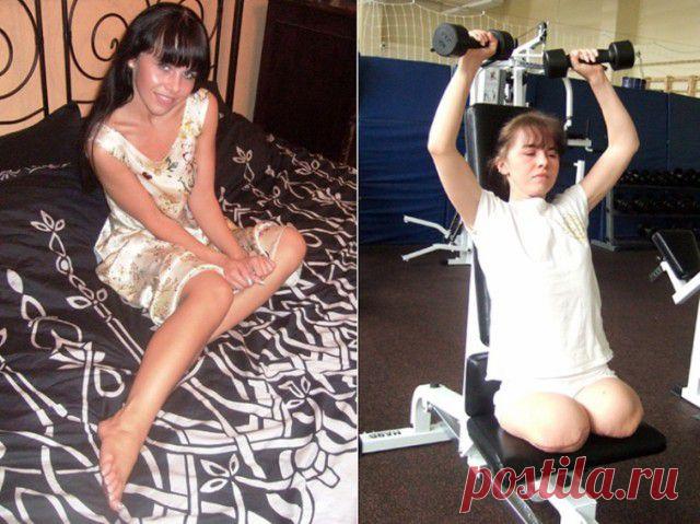 Непреодолимое желание жить и быть счастливой русской девушки без ног - Фото - Калейдоскоп Эмоций