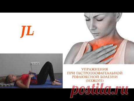 Упражнения при гастроэзофагеальной рефлюксной болезни (ГЭРБ). Изжога.
