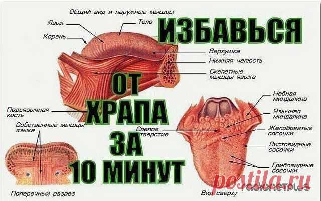 КАК ЗА 10 МИНУТ ИЗБАВИТЬСЯ ОТ ХРАПА НАДОЛГО