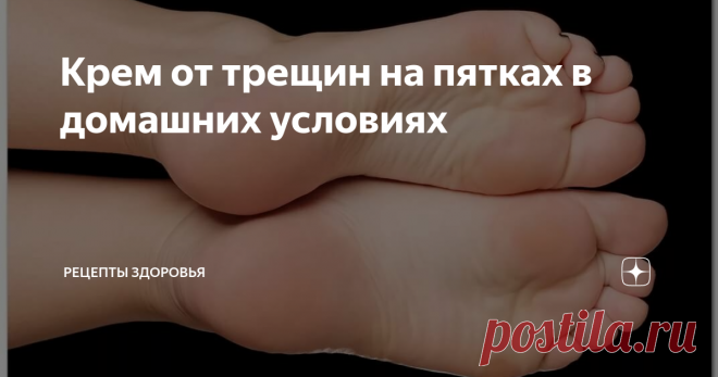 Крем от трещин на пятках в домашних условиях Я за свою жизнь никогда не знала проблем со своими пятками. Но, как говорится, 
