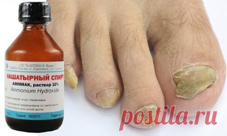ТРИ РЕЦЕПТА ЛЕЧЕНИЯ ГРИБКА НА НОГТЯХ
1 ложку нашатырного спирта необходимо развести в стакане воды.
В этом растворе необходимо смочить любую ткань, но только не синтетическую. Этой тряпкой необходимо обернуть пораженный палец, наверх надеть целлофановый пакет, а затем носок.
Эти действия необходимо повторить в течение 5 дней, после чего грибок исчезнет.
Можно приготовить мазь из сырого куриного яйца, 1 столовой ложки уксуса, 1 столовой ложки растительного масла и 1 чайной ложки диметилфталата.