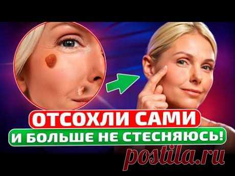 Жидкий «хирург без ножа»! Папилломы, бородавки и другие образования на коже боятся этого средства!