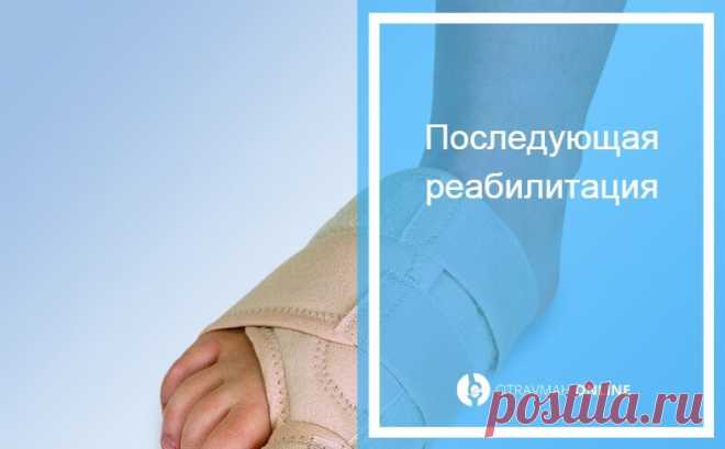 Перелом пальца ноги - без смещения