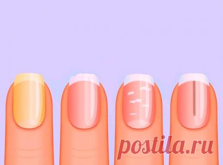 Что ногти расскажут о вашем здоровье / Будьте здоровы