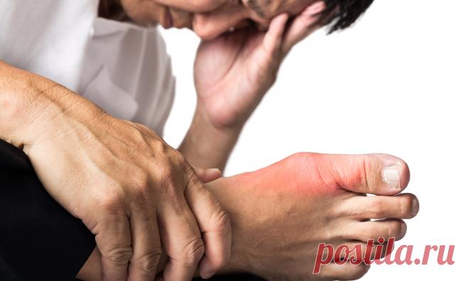 Вот как устранить кристаллизацию мочевой кислоты из вашего тела, чтобы бороться с болью в суставах и подагрой! Попробуйте! Образование кристаллов мочевой кислоты в суставах является результатом неправильного выбора образа жизни. Если вовремя не лечить, это может