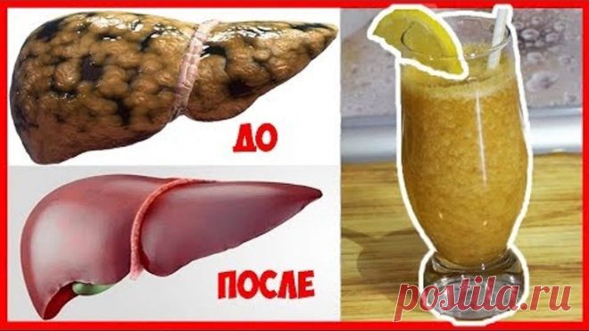 ✔Этот напиток быстро очистит ПЕЧЕНЬ и КРОВЬ, Повысит ИММУНИТЕТ и Омолодит ОРГАНИЗМ