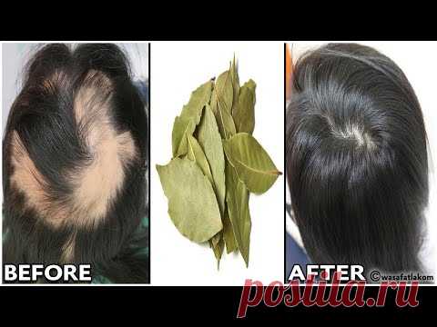 Индийский секрет 🌿 для ускорения роста волос и лечения облысения с первой недели.