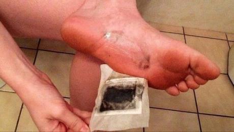 Как с помощью лука и чеснока вывести токсины 
 
Впервые такие примочки для ног начали использовать на Востоке. 
Эти компрессы размещают на ногах перед сном, а уже утром они будут темными — это токсины, которые вышли из нашего тела.Как вам такой чудо эксперимент? Давайте попробуем! 
 
Малоподвижный образ жизни, неправильное питание, инфекционные заболевания и вредные привычки приводят к тому, что в организме начинают накапливаться различные токсические вещества. А это не лучшим образом сказываетс