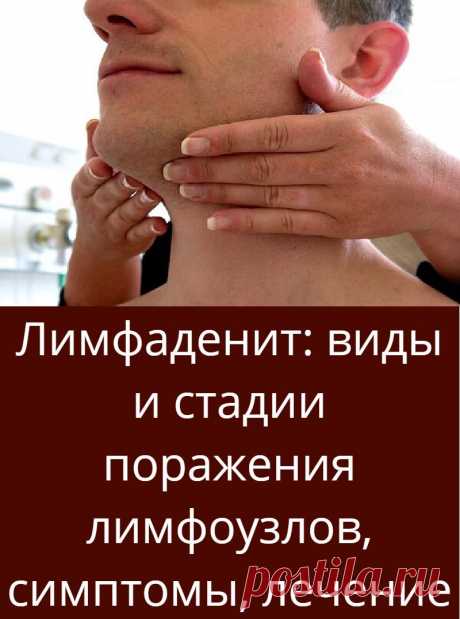 Лимфаденит: виды и стадии поражения лимфоузлов, симптомы, лечение