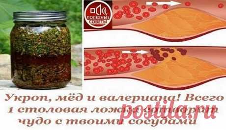 Укроп, мед, валериана - и сосуды без изъяна! 
Вас беспокоят захламленные бляшками сосуды, поэтому их-то надо почистить в первую очередь.

Для этого приготовить вот такой настой: 1 стакан укропного семени, 2 ст. ложки молотого корня валерианы сме…