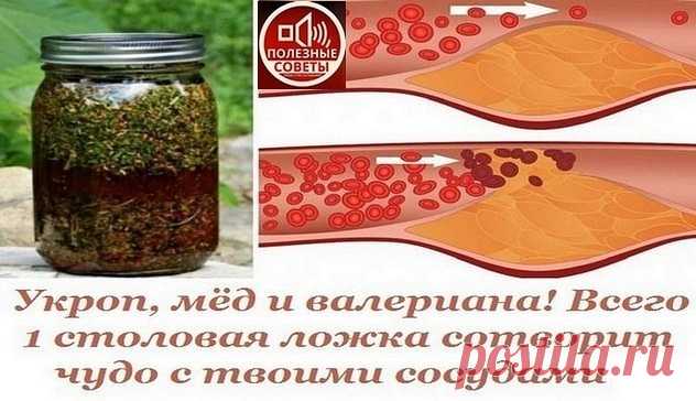 Укроп, мед, валериана - и сосуды без изъяна! 
Вас беспокоят захламленные бляшками сосуды, поэтому их-то надо почистить в первую очередь.

Для этого приготовить вот такой настой: 1 стакан укропного семени, 2 ст. ложки молотого корня валерианы сме…