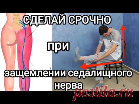 Защемление седалищного нерва! Сделай СРОЧНО и станет гораздо легче!
