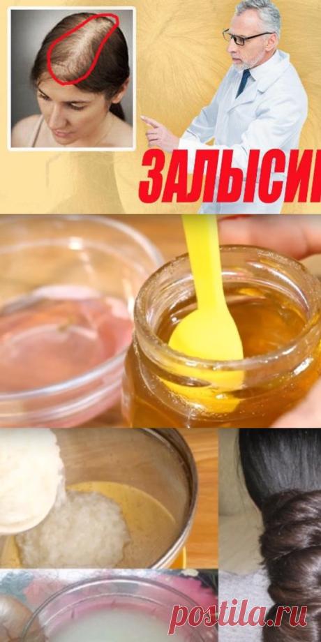 Залысины? Врач показал домашний способ, как сделать волосы густыми за 7 дней! Всего 4 ингредиента. - Все своими руками