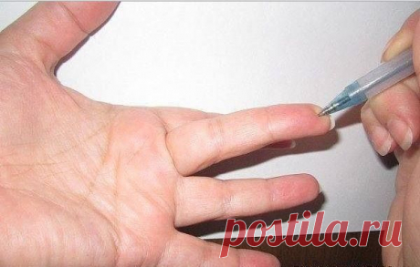 Точка &quot;скорая помощь&quot; при высоком давлении и точка устранения злости.