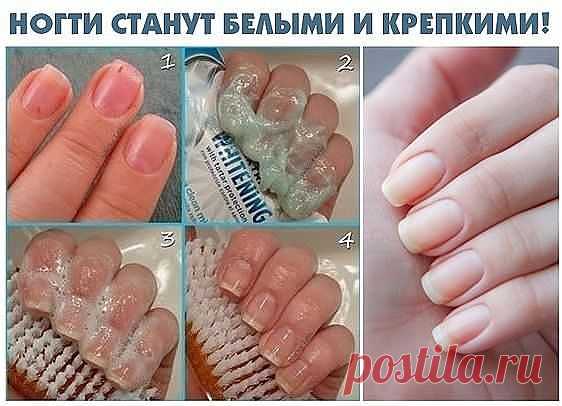 РЕЦЕПТ УХОДА ЗА НОГТЯМИ. Советую всем!
Чтобы ногти всегда выглядели ухоженными и были белыми, длинными и крепкими советую этот рецепт!