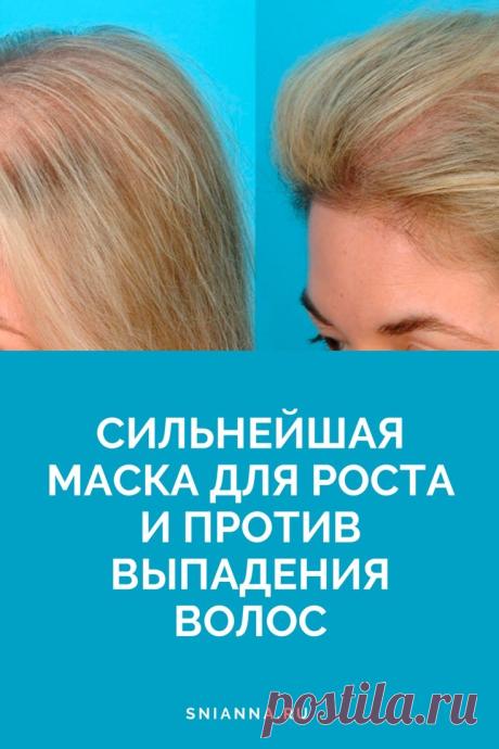 Сильнейшая маска для роста и против выпадения волос
Это очень простая и эффективная маска, готовить ее элементарно.
Ингредиенты: ➡️Кликайте на фото, чтобы прочитать статью полностью