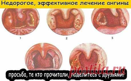 (2) Одноклассники