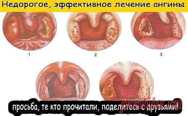 (2) Одноклассники