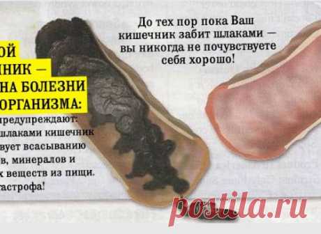 У вас около 9 кг ядов в прямой кишке — вот что вы можете сделать