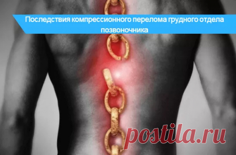 Компрессионный перелом позвоночника грудного отдела 🔎 от чего может быть
