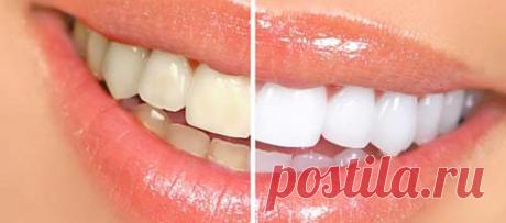 Air Flow – чистка зубов в кабинете стоматолога | Краше Всех