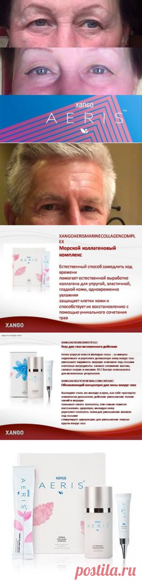 (5) XangoAeris и Я