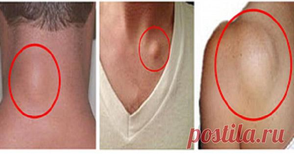 Быстрое и простое удаление жировой ткани совершенно естественным способом - interesno.win