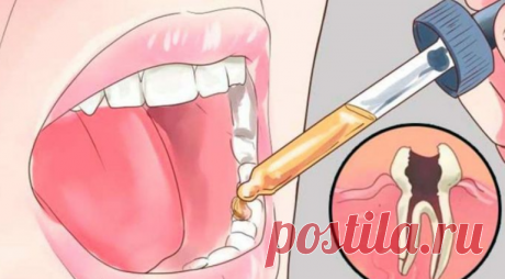 Вот как снять любую зубную боль всего за несколько секунд