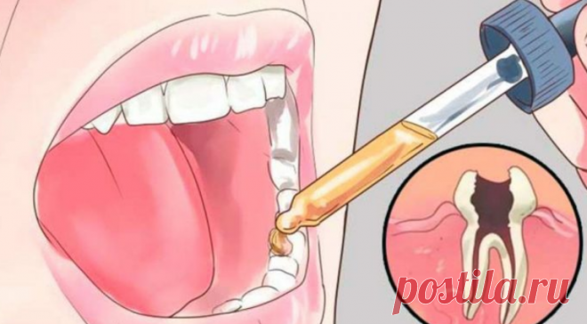 Вот как снять любую зубную боль всего за несколько секунд