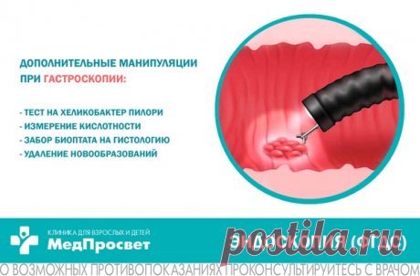 Как проводится #ФГДС (гастроскопия)?

Процедура проводится натощак (12 часов голода перед процедурой).

Гастроскопию выполняет врач - эндоскопист. Перед введением эндоскопа пациенту в ротовую полость:
Показать полностью...