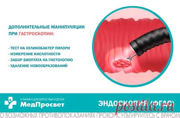 Как проводится #ФГДС (гастроскопия)?

Процедура проводится натощак (12 часов голода перед процедурой).

Гастроскопию выполняет врач - эндоскопист. Перед введением эндоскопа пациенту в ротовую полость:
Показать полностью...