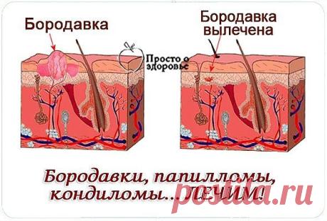 (99+) Одноклассники
