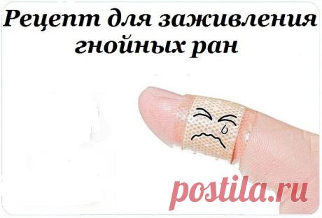 здоровье, народная медицина | Записи в рубрике здоровье, народная медицина | Дневник ziaka77