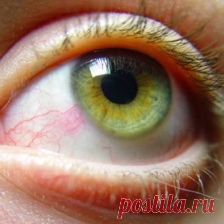 Красные глаза: 10 причин | Maiden.com.ua