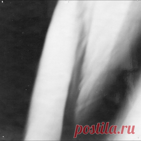 Petrified Entity - Downfall (2025) 320kbps / FLAC
