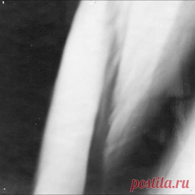 Petrified Entity - Downfall (2025) 320kbps / FLAC