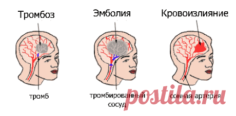 Лекарственные растения при нарушении мозгового кровообращения