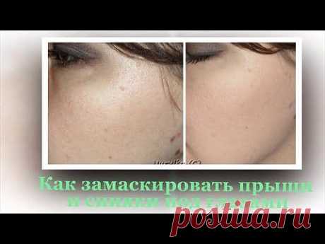 Красота и уход за собой, макияж глаз, видео уроки макияжа: для карих глаз, для голубых глаз, визаж: Как избавиться от темных кругов под глазами. Полезные советы для красоты и здоровья.