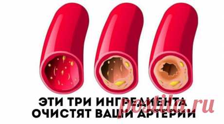 Эти 3 простых ингредиента могут стать мощным средством для очистки ваших коронарных сосудов