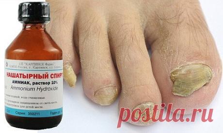 ТРИ РЕЦЕПТА ЛЕЧЕНИЯ ГРИБКА НА НОГТЯХ
1 ложку нашатырного спирта необходимо развести в стакане воды.
В этом растворе необходимо смочить любую ткань, но только не синтетическую. Этой тряпкой необходимо обернуть пораженный палец, наверх надеть целлофановый пакет, а затем носок.
Эти действия необходимо повторить в течение 5 дней, после чего грибок исчезнет.
Можно приготовить мазь из сырого куриного яйца, 1 столовой ложки уксуса, 1 столовой ложки растительного масла и 1 чайной ложки диметилфталата.