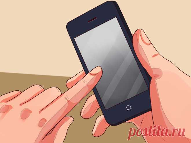 Как жить с фибрилляцией предсердий Фибрилляция предсердий (ФП) - это одна из наиболее распространённых аритмий. Для нее характерна хаотичная, быстрая и нерегулярная активация предсердий, которая, как следствие, вызывает неправильную реакцию желудочков; верхние камеры сердца ...