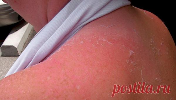 Вот что будет, если положить в ухо кусочек лука. Почему я не знал об этом раньше? - Современная леди