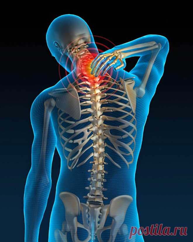 Симптомы и лечение. Миозит шеи Миозит – воспалительный процесс, затрагивающий одну или несколько скелетных мышц. Может протекать в острой и хронической форме. Характеризуется локальной болью в области поражения и дальнейшим ее распространением на новые участки.