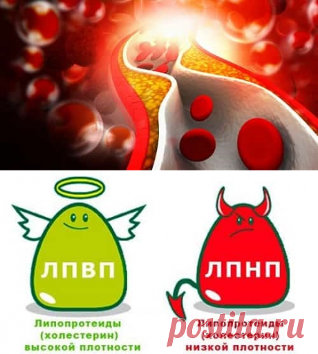 Холестерин в крови: расшифровка анализа и отклонение от нормы