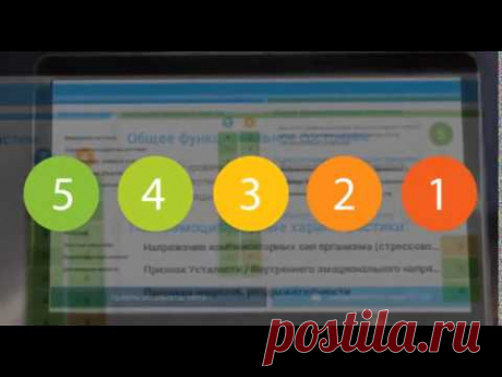 VIP Rofes   Vision Тест