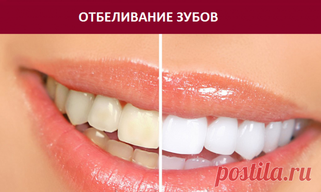 7 простых способов отбелить зубы — Домашние заботы