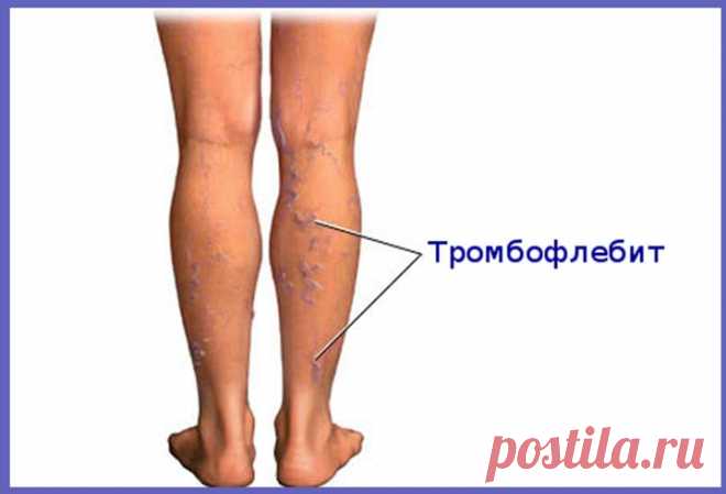 Новости - МирТесен